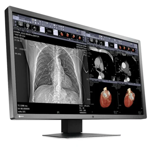 Медицински монитор EIZO RadiForce MX315W 8MP Цветен - Image 3