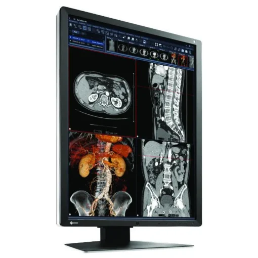 Медицински монитор EIZO RadiForce RX250 2MP Цветен - Image 3