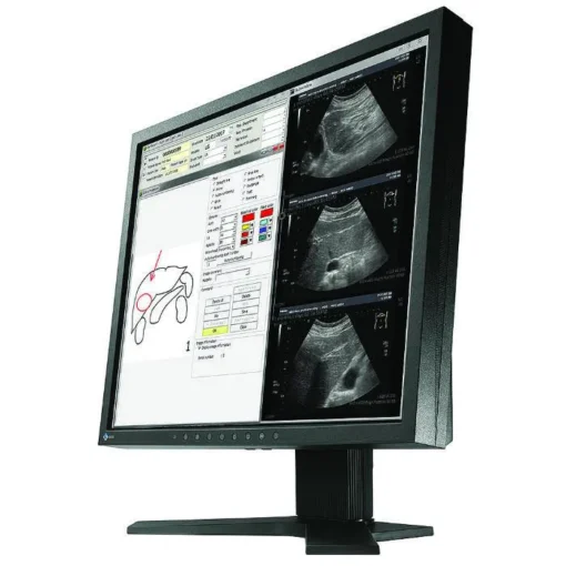 Медицински монитор EIZO RadiForce MX194 1MP Цветен - Image 5