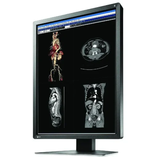 Медицински монитор EIZO RadiForce MX216-SB 2MP Цветен - Image 3