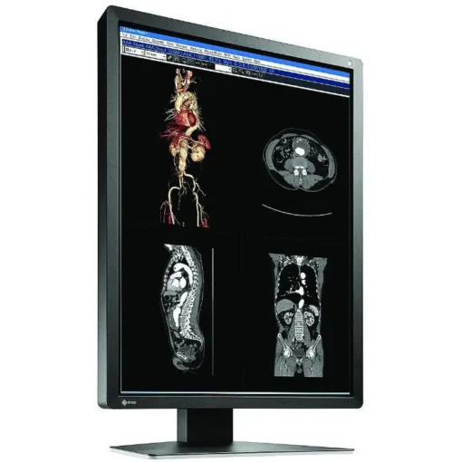 Медицински монитор EIZO RadiForce MX216-SB 2MP Цветен - Image 4