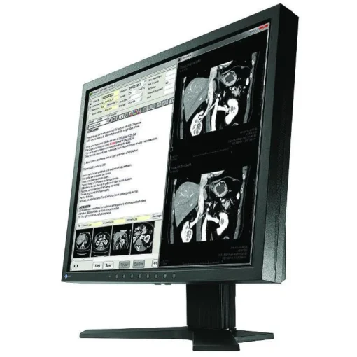 Медицински монитор EIZO RadiForce MX194 1MP Цветен - Image 3