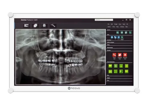 AG NEOVO Monitor 21.5 inches DR-2202 IPS NeoV GLASS 9H IP65* DICOM 500CD/M2 1000:1 5MS DP HDMI VGA USB SPEAKERS WHITE - Image 3