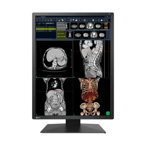 Медицински монитор EIZO Radi Force RX270 - 21.3