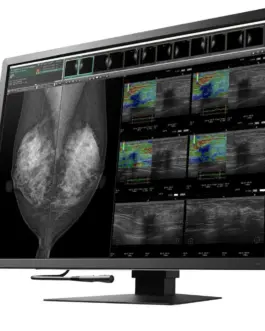 Alternative view of Медицински монитор EIZO RadiForce RX1270 12MP Цветен