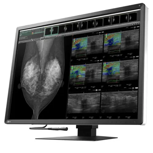 Alternative view of Медицински монитор EIZO RadiForce RX1270 12MP Цветен