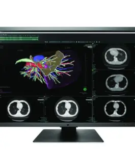 Медицински монитор EIZO RadiForce RX660 6MP Цветен