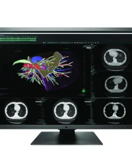 Медицински монитор EIZO RadiForce RX660 6MP Цветен