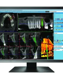 Медицински монитор EIZO RadiForce MX216-HB 2MP Цветен