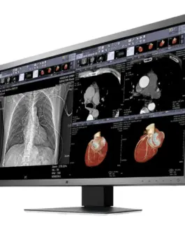 Alternative view of Медицински монитор EIZO RadiForce MX315W 8MP Цветен