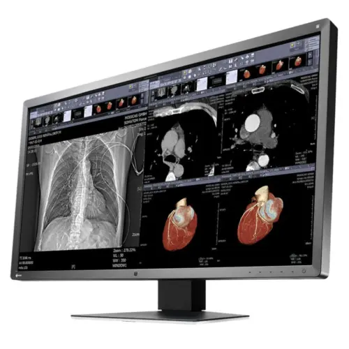 Alternative view of Медицински монитор EIZO RadiForce MX315W 8MP Цветен
