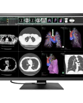 Медицински монитор EIZO RadiForce RX1270 12MP Цветен