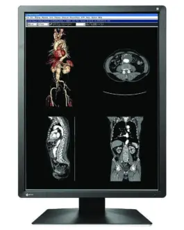 Alternative view of Медицински монитор EIZO RadiForce MX216-SB 2MP Цветен