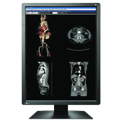 Alternative view of Медицински монитор EIZO RadiForce MX216-SB 2MP Цветен