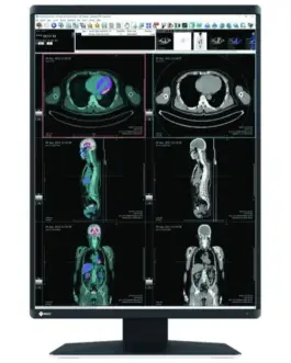 Медицински монитор EIZO RadiForce RX560 5MP Цветен