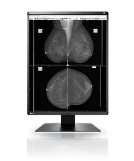 Медицински монитор EIZO RadiForce GX560 5MP Монохромен