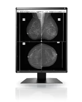 Медицински монитор EIZO RadiForce GX560 5MP Монохромен