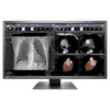 Медицински монитор EIZO RadiForce MX315W 8MP Цветен