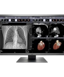 Медицински монитор EIZO RadiForce MX315W 8MP Цветен