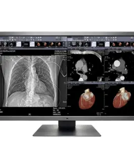 Медицински монитор EIZO RadiForce MX315W 8MP Цветен