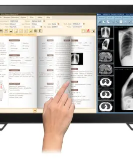 Alternative view of Медицински монитор EIZO RadiForce MS236WT 2MP Цветен, Тъч
