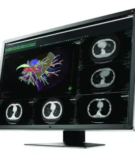 Alternative view of Медицински монитор EIZO RadiForce RX660 6MP Цветен