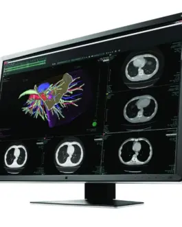 Alternative view of Медицински монитор EIZO RadiForce RX660 6MP Цветен