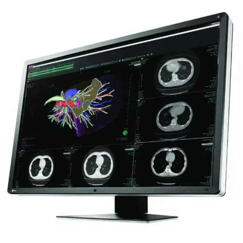 Alternative view of Медицински монитор EIZO RadiForce RX660 6MP Цветен