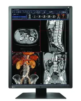 Медицински монитор EIZO RadiForce RX250 2MP Цветен