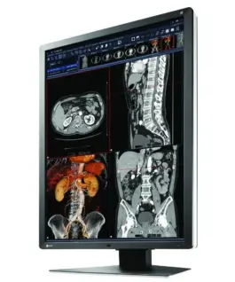 Alternative view of Медицински монитор EIZO RadiForce RX250 2MP Цветен