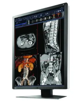 Alternative view of Медицински монитор EIZO RadiForce RX250 2MP Цветен