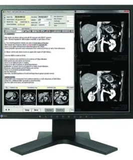 Медицински монитор EIZO RadiForce MX194 1MP Цветен