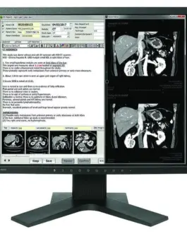 Медицински монитор EIZO RadiForce MX194 1MP Цветен