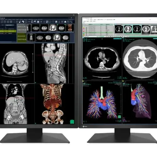 Alternative view of Медицински монитор EIZO Radi Force RX270 - 21.3" инч, 2MP Цветен LED