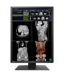 Медицински монитор EIZO Radi Force RX270 - 21.3
