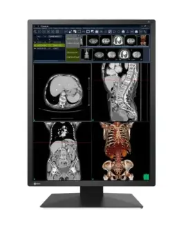 Медицински монитор EIZO Radi Force RX270 - 21.3" инч 2MP Цветен LED