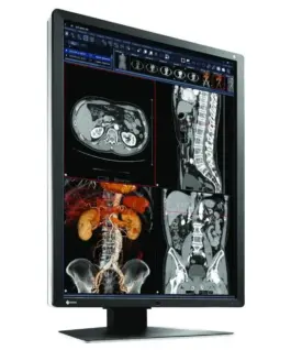 Медицински монитор EIZO RadiForce RX250 2MP Цветен