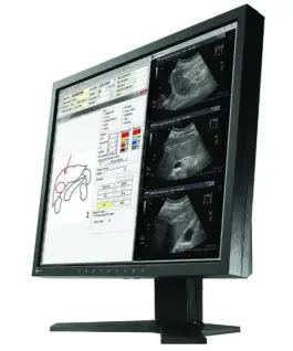 Медицински монитор EIZO RadiForce MX194 1MP Цветен