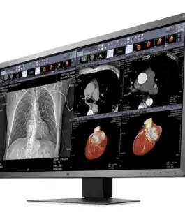 Alternative view of Медицински монитор EIZO RadiForce MX315W 8MP Цветен