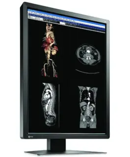 Медицински монитор EIZO RadiForce MX216-SB 2MP Цветен