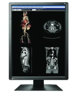 Alternative view of Медицински монитор EIZO RadiForce MX216-SB 2MP Цветен