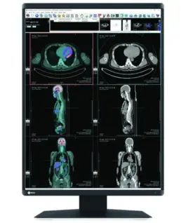 Медицински монитор EIZO RadiForce RX560 5MP Цветен