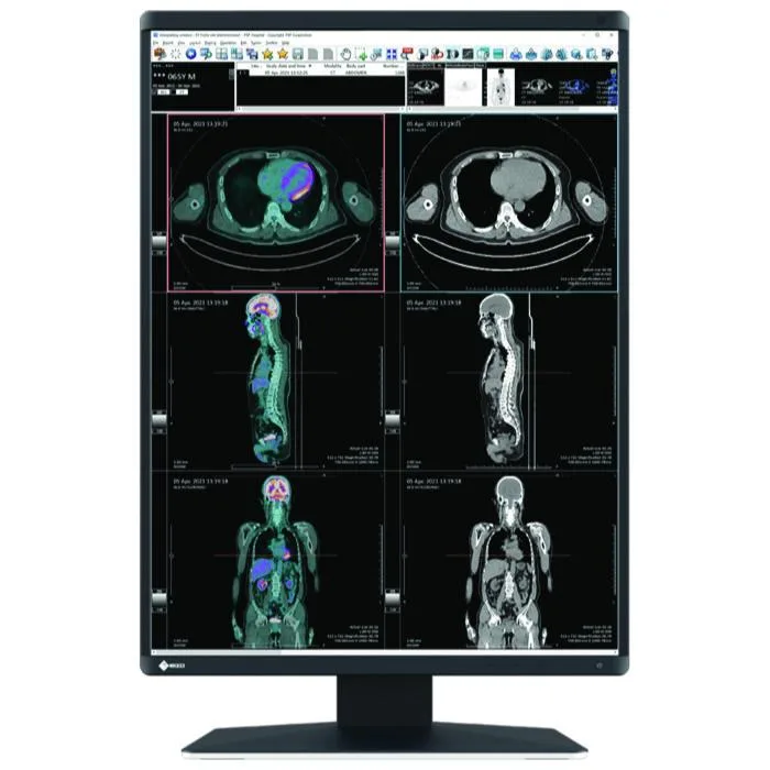 Медицински монитор EIZO RadiForce RX560 5MP Цветен
