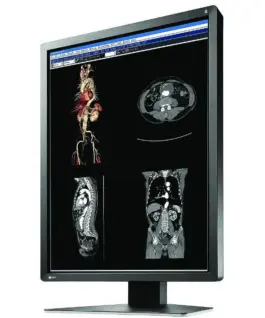 Медицински монитор EIZO RadiForce MX216-HB 2MP Цветен