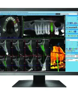 Медицински монитор EIZO RadiForce MX216-SB 2MP Цветен
