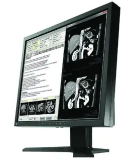 Медицински монитор EIZO RadiForce MX194 1MP Цветен