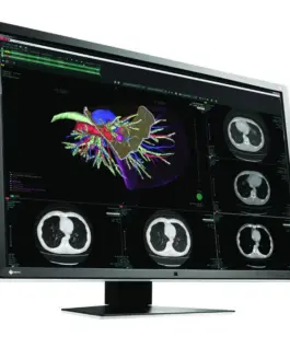Медицински монитор EIZO RadiForce RX660 6MP Цветен