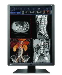 Медицински монитор EIZO RadiForce RX250 2MP Цветен